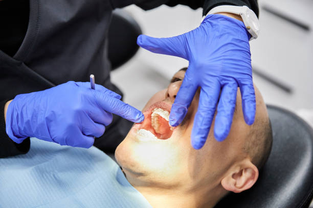 Best Emergency Denture Repair in Spearville, KS